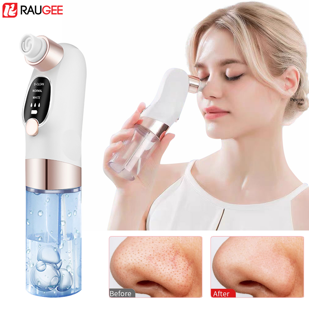 Blackhead Remover Electric Bla - огляд і ціна Air Bubble Remover
