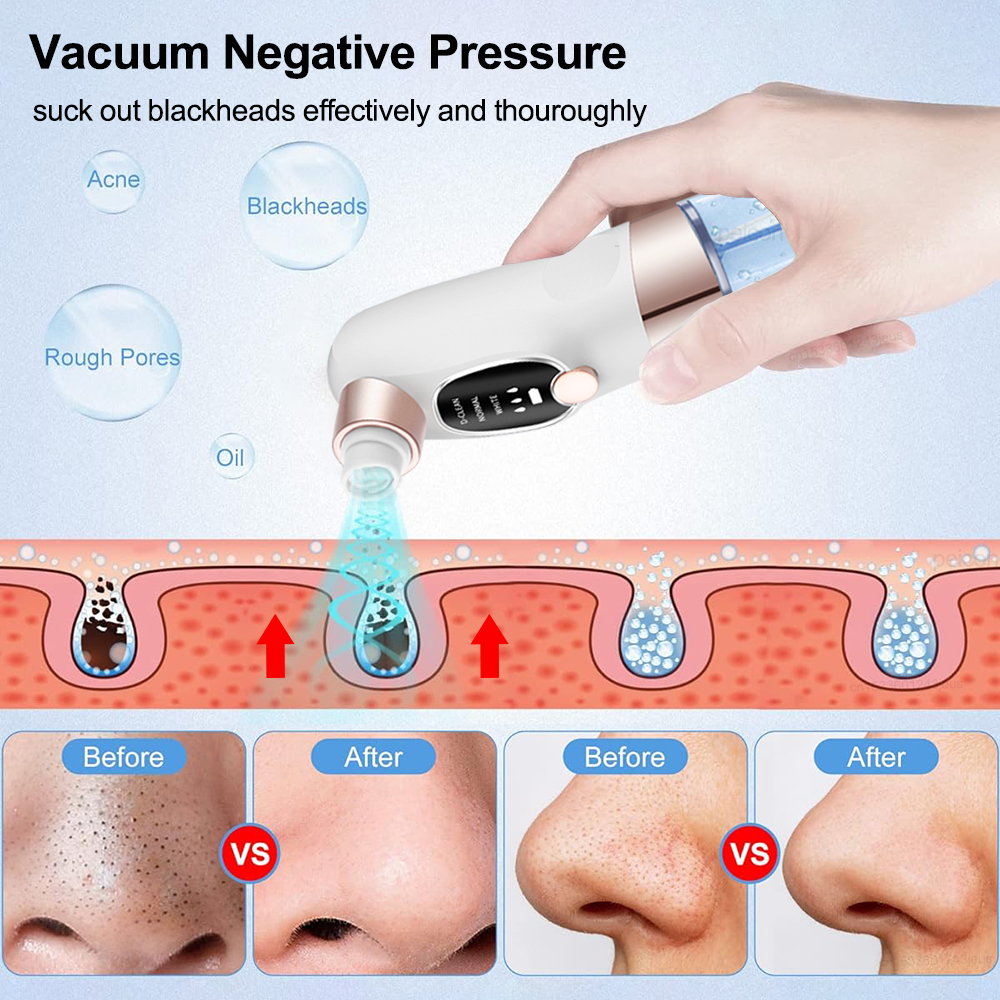 Blackhead Remover Electric Bla - огляд і ціна Air Bubble Remover